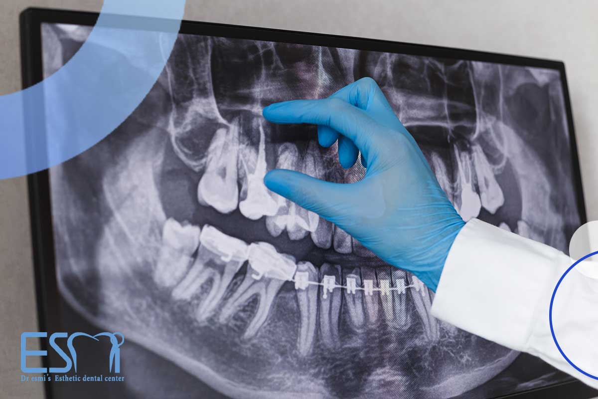 چه کسی می‌تواند از تکنیک جراحی افزایش طول تاج دندان دندان انجام دهد؟