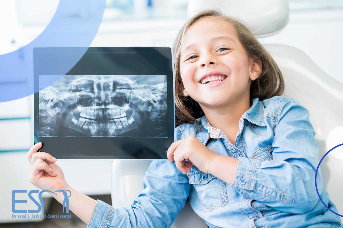آیا در طول عصب کشی دندان کودکان فرزند شما مورد آسیب قرار می گیرد؟