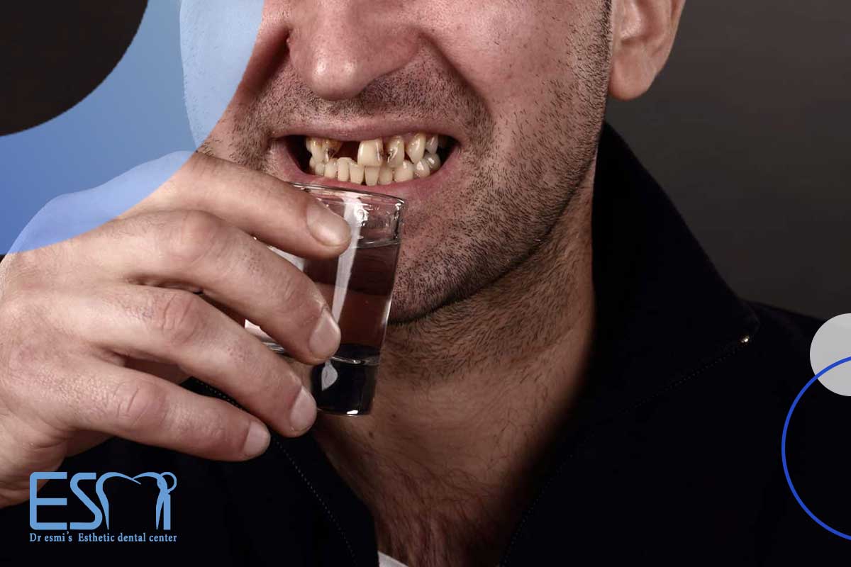 آیا مینای ضعیف دندان قابل درمان است؟
